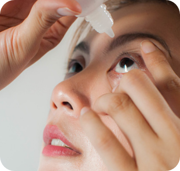 Woman looking up, holding her eye open while using an eye drop applicator.
